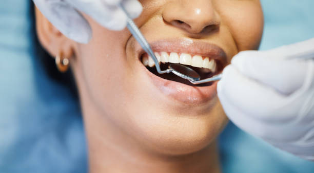 Best Broken or Chipped Tooth Repair in Appleton, WI