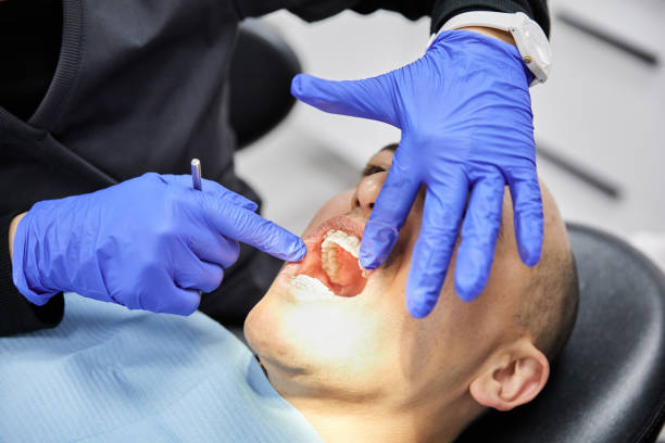 Best Emergency Wisdom Tooth Extraction in Appleton, WI